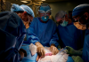 Médicos transplantam com sucesso rim de porco em humano