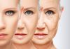 Flacidez facial tem solução!