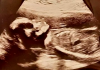 Mãe fica extremamente assustada com imagem de filha em ultrassom; entenda