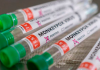 Anvisa autoriza dispensa registro de vacinas para varíola dos macacos