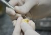 Você sabe como funciona um Banco de Dentes Humanos