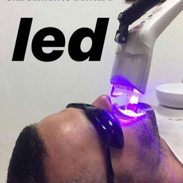 Clareamento dental: o que você precisa saber