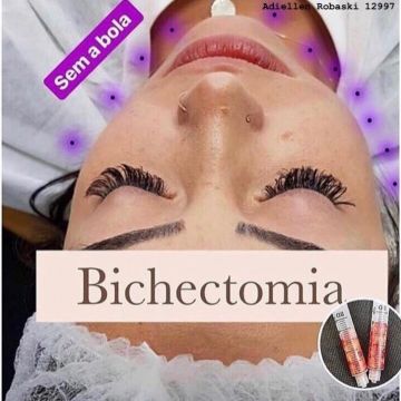 Bichectomia: o segredo para afinar o rosto