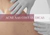 Você tem acne nas costas?