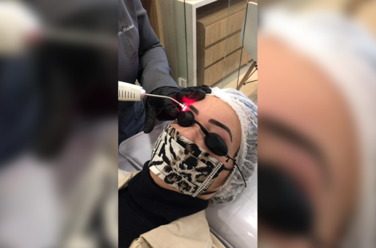 Consegui consertar minha sobrancelha!